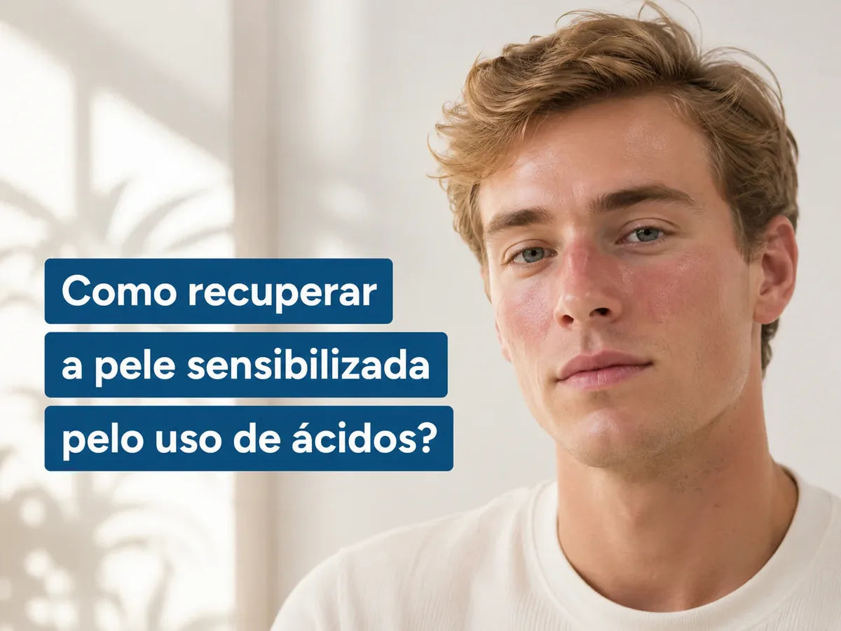 Como recuperar a pele sensibilizada pelo uso de ácidos?