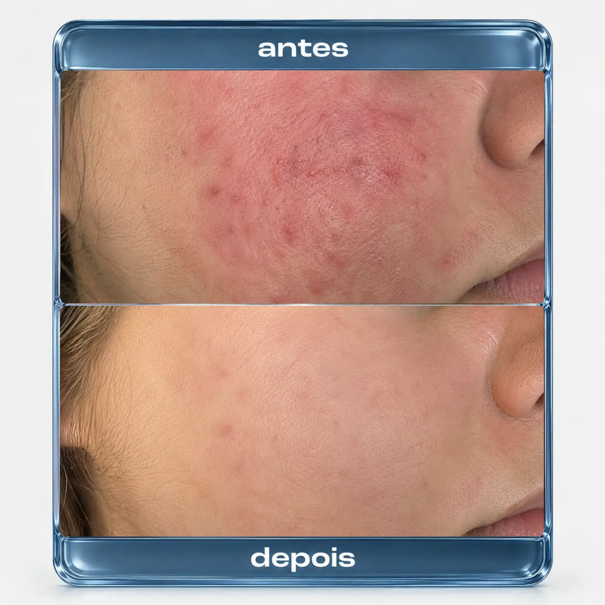 Protocolo HidraRepair Calmante e Anti-vermelhidão