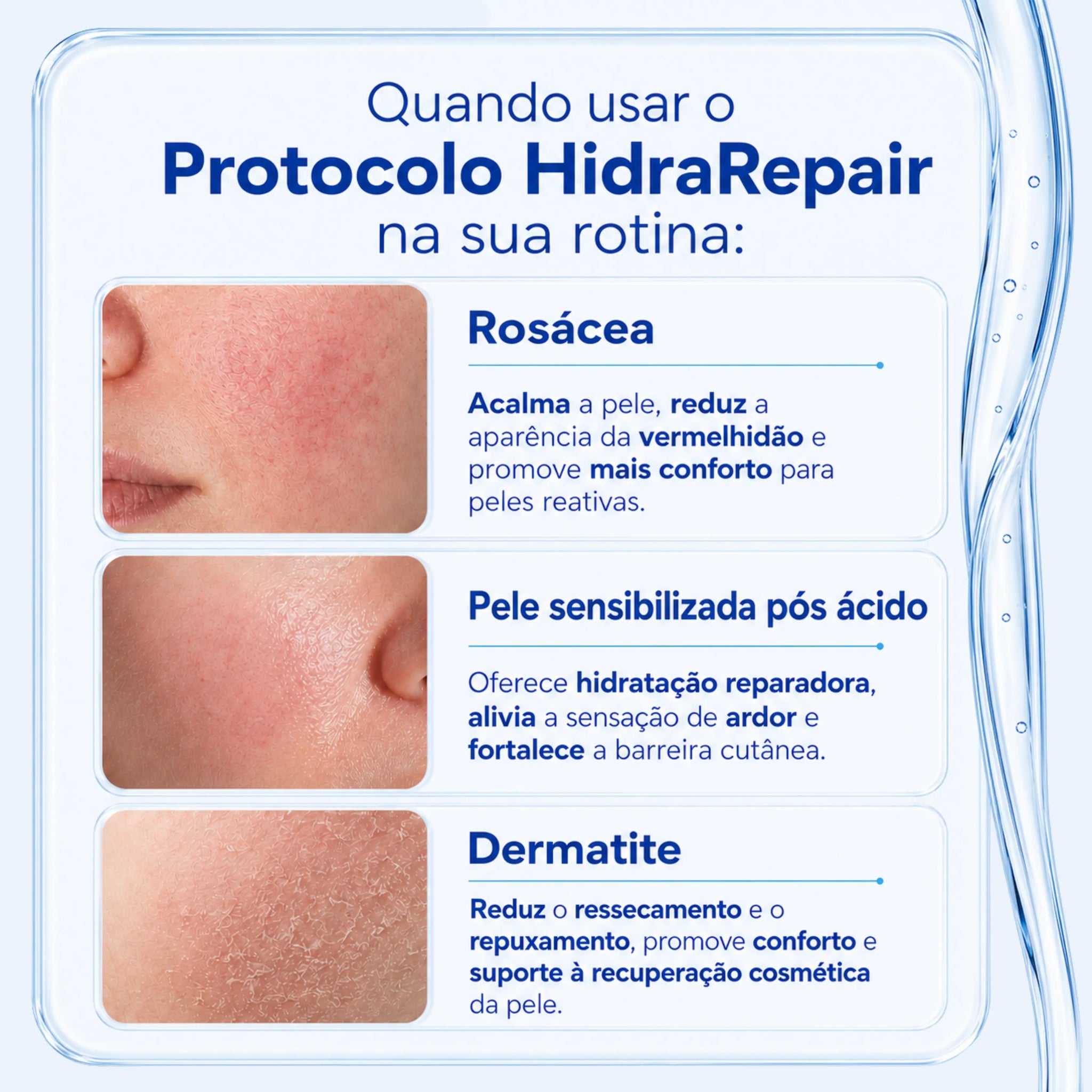 Protocolo HidraRepair Calmante e Anti-vermelhidão
